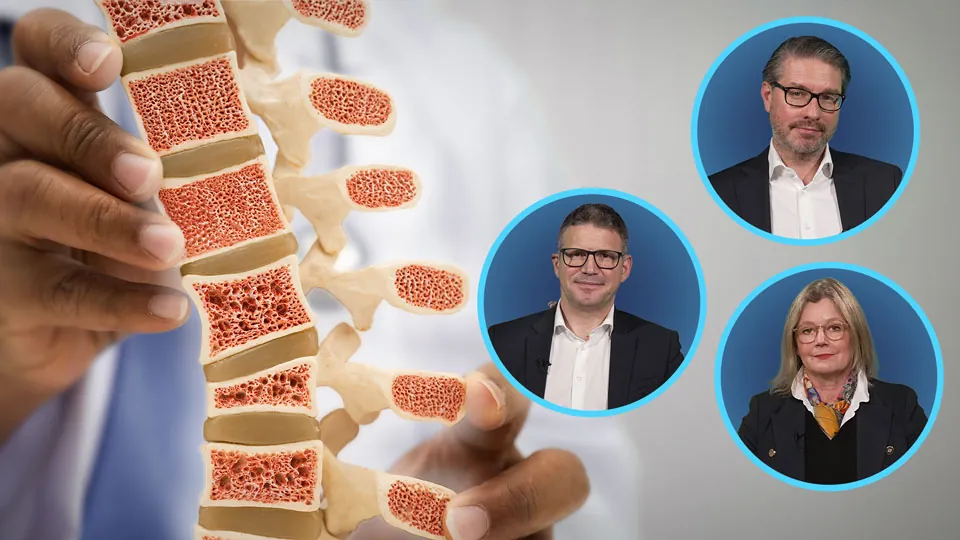 Update Osteoporose: Leitlinie, Sequenz-Therapie und neue Daten