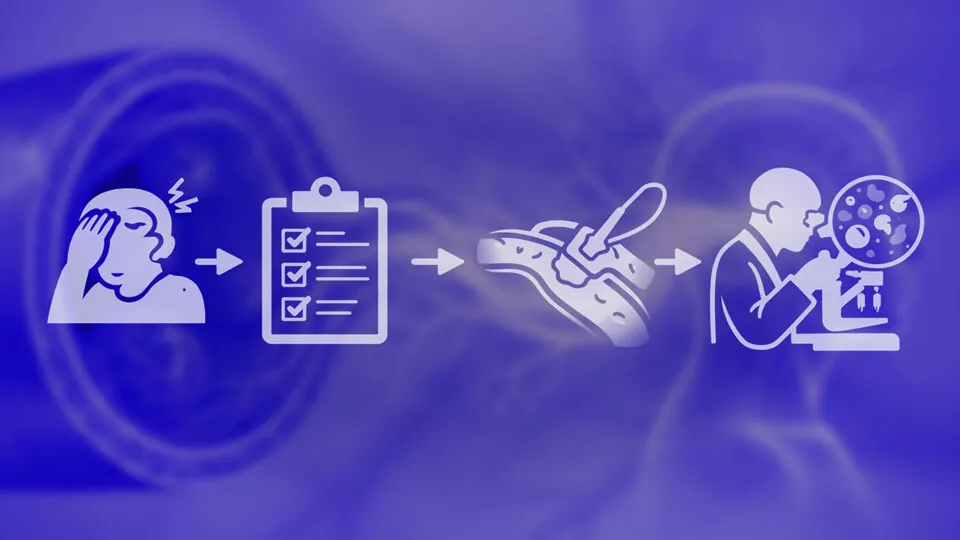 Glukokortikoid-sparende Therapiestrategien