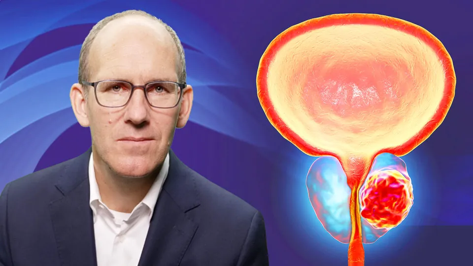 Medikamentöse Therapie des hormon-sensitiven Prostatakarzinoms