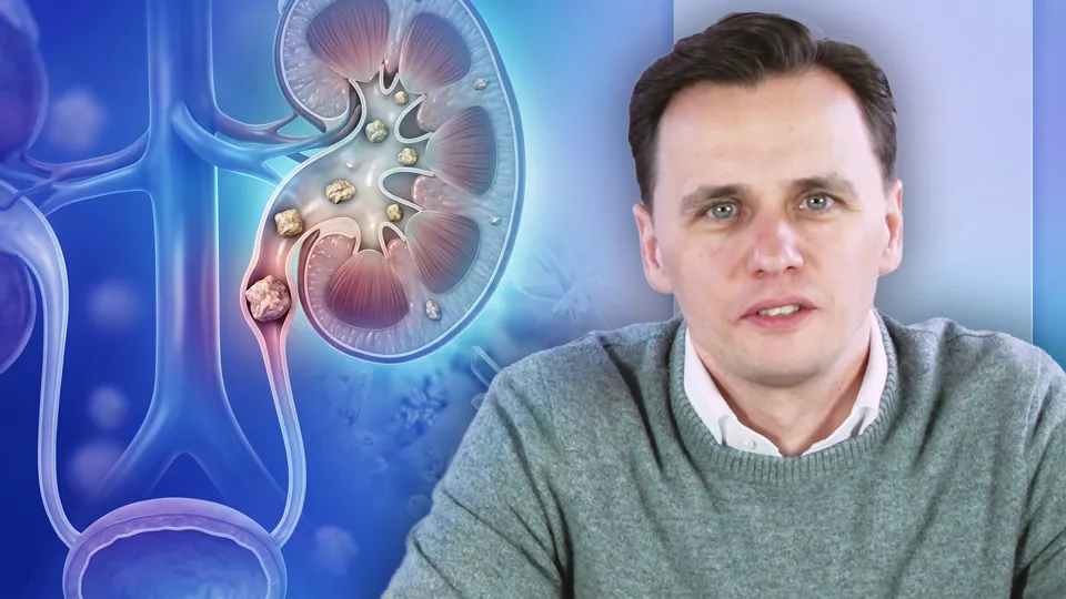 Urolithiasis - Rezidivprophylaxe Teil 1