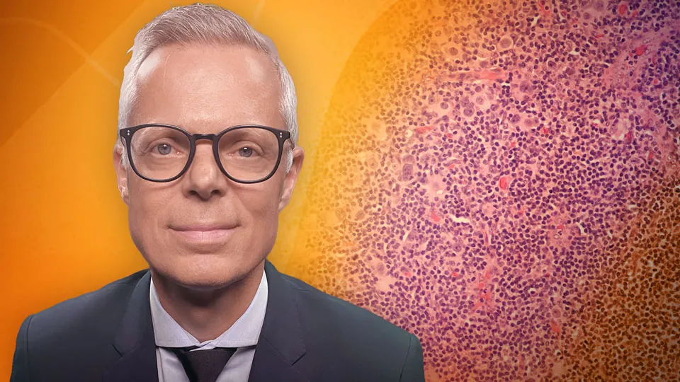 Therapieoptionen beim HR+/HER2- metastasierten Mammakarzinom