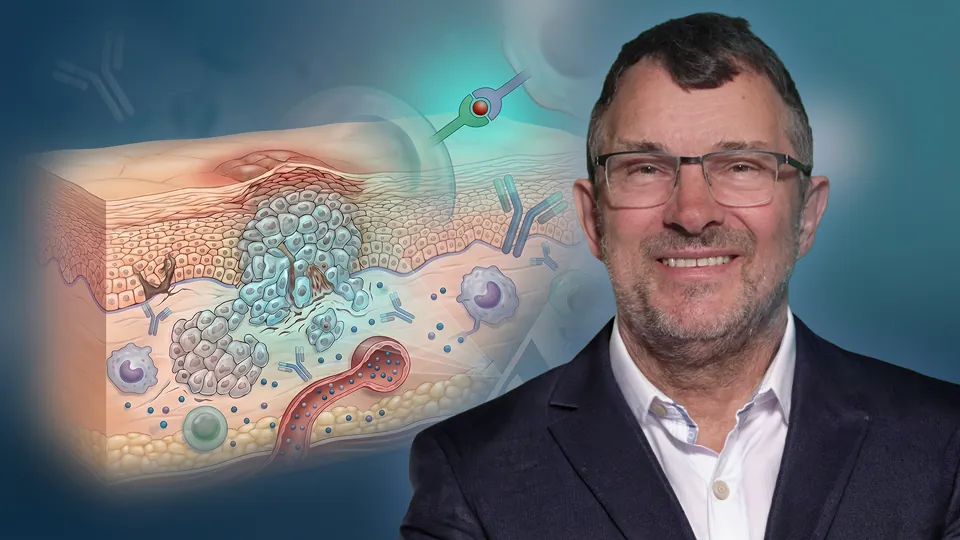 Adjuvante Behandlungsoptionen beim High Risk CSCC