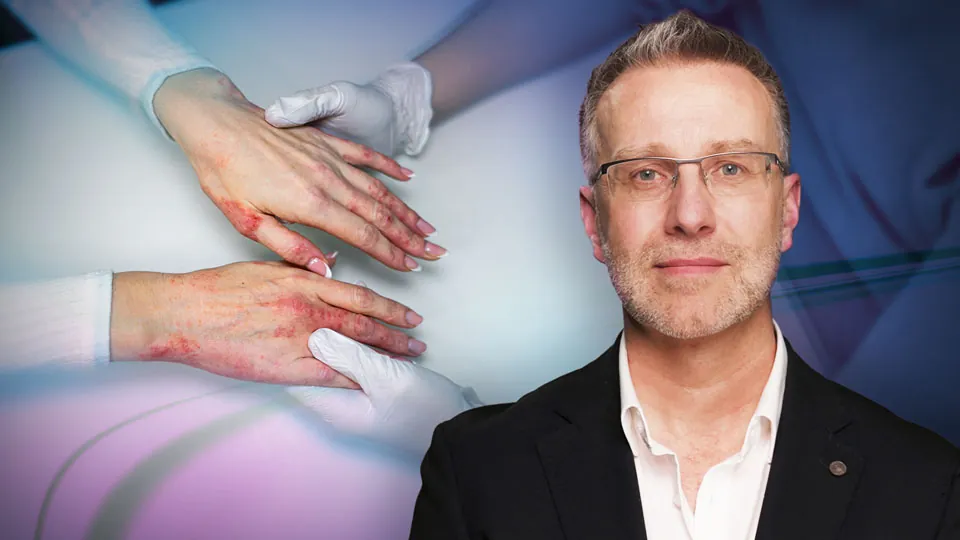 Atopische Dermatitis: Versorgungslücken schließen, modern therapieren