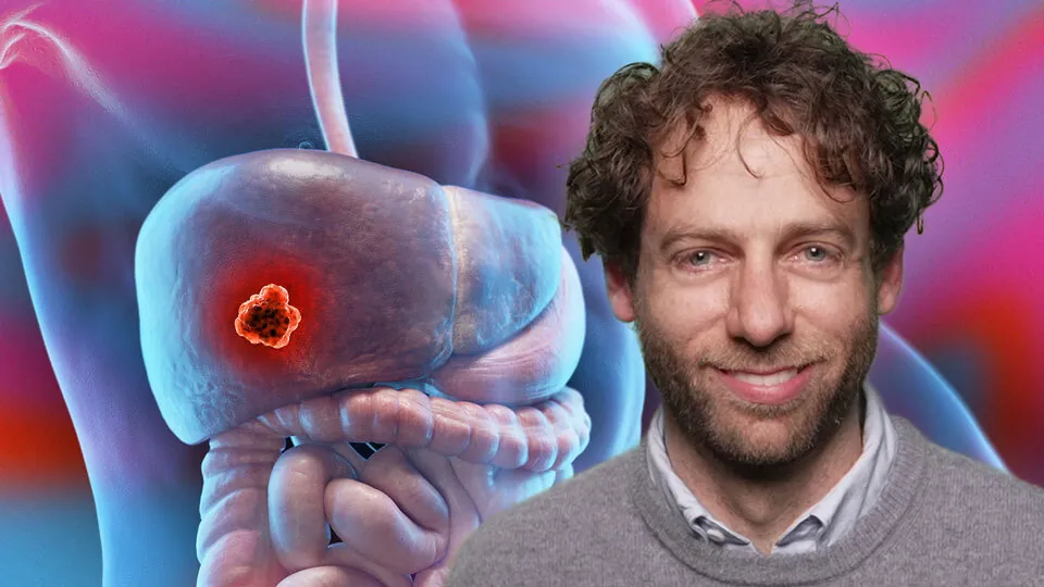 State of the Art: Management des hepatozellulären Karzinoms