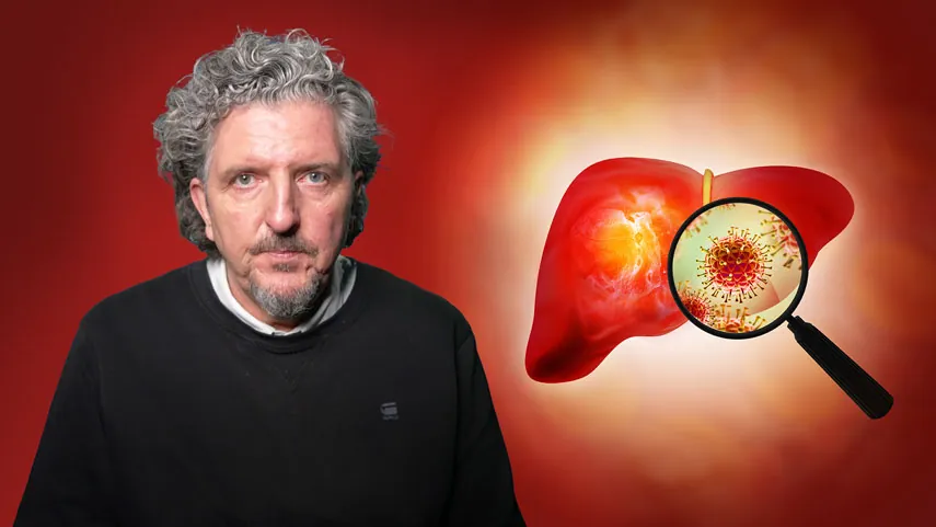 Hepatitis C