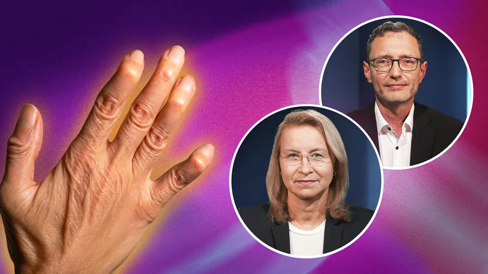 Psoriasis-Arthritis: Real-World-Daten für die Praxis