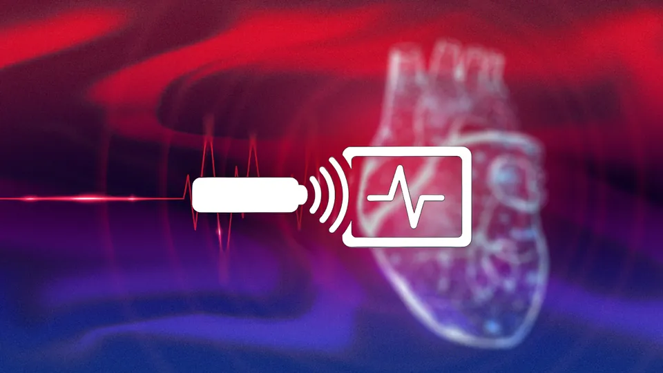 Diagnostik der kardialen Amyloidose strukturiert durchführen