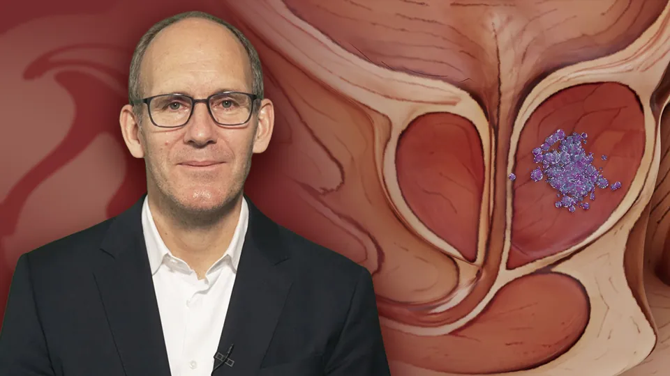 State of the Art: Lokalisiertes Prostatakarzinom 2026