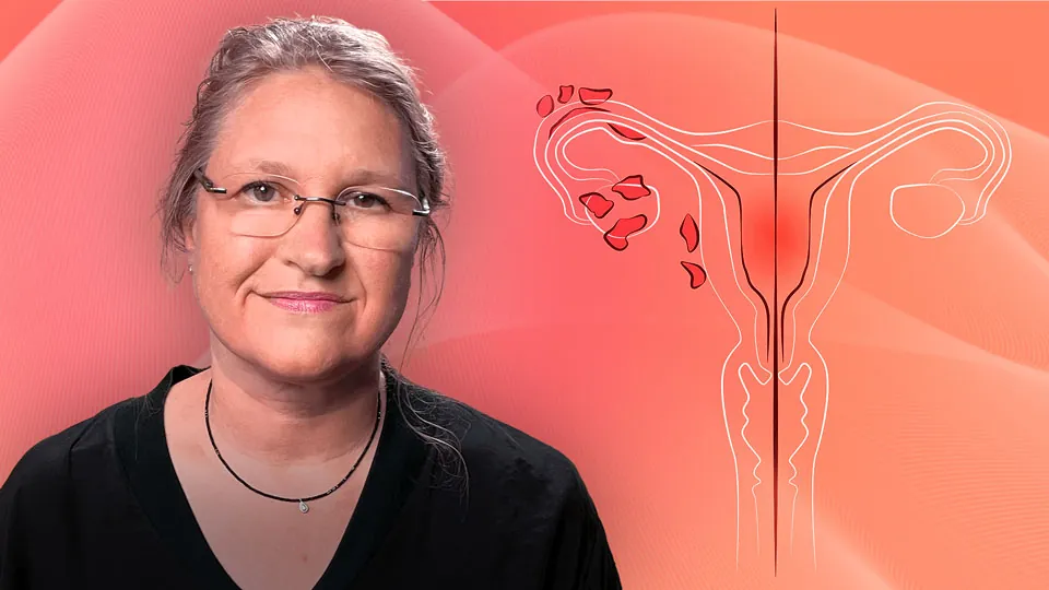 Diagnostik und Therapie der Endometriose