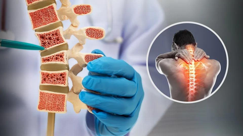 Update Osteoporose: Leitlinie, Sequenz-Therapie und neue Daten