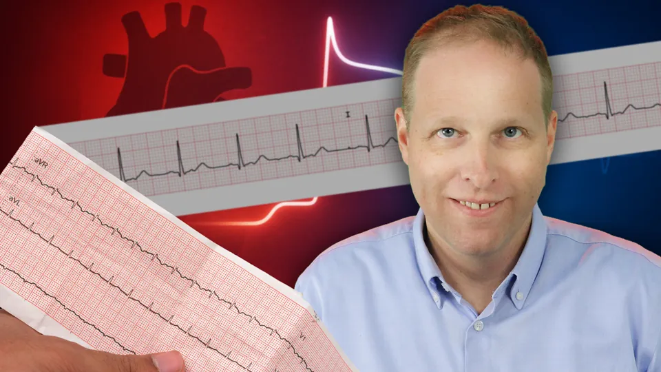 EKG-Kurs: Von den Grundlagen zur sicheren Befundung